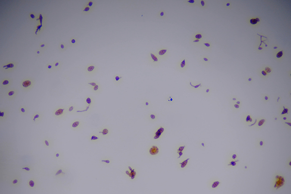 孢子捕捉儀圖片1 孢子捕捉儀圖片1